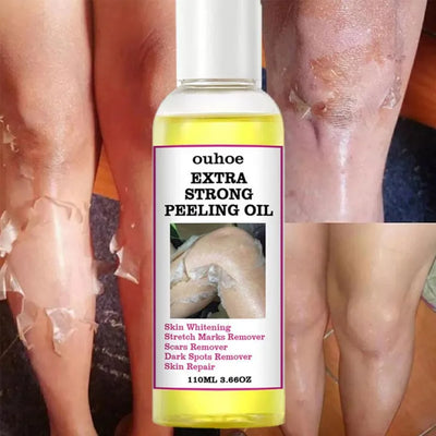 Yellow Peeling Oil 110ml Super Strength Dead Skin Remover